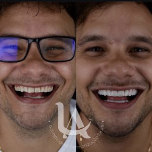 Facetas campo grande ms