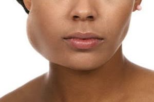 edema facial